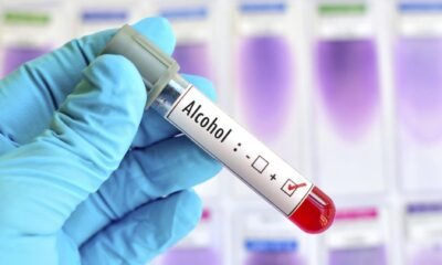 A lab assistant sowing results of pre-employment drug screening test